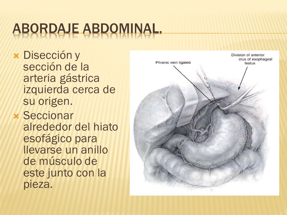 Lfk a la osteocondrosis sheynogo del departamento de la columna vertebral